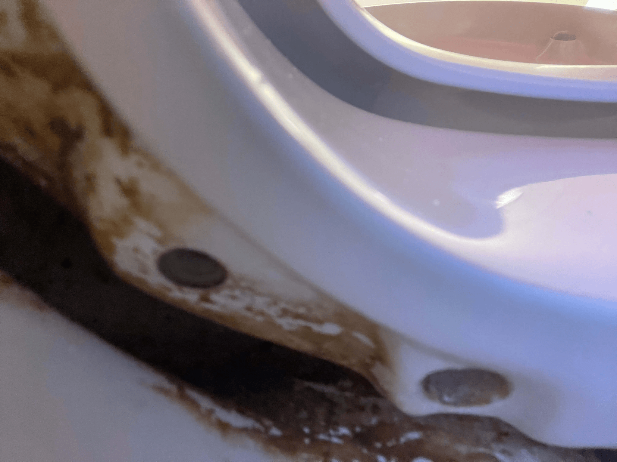 Hidden dirt and staining beneath a hotel toilet seat rim